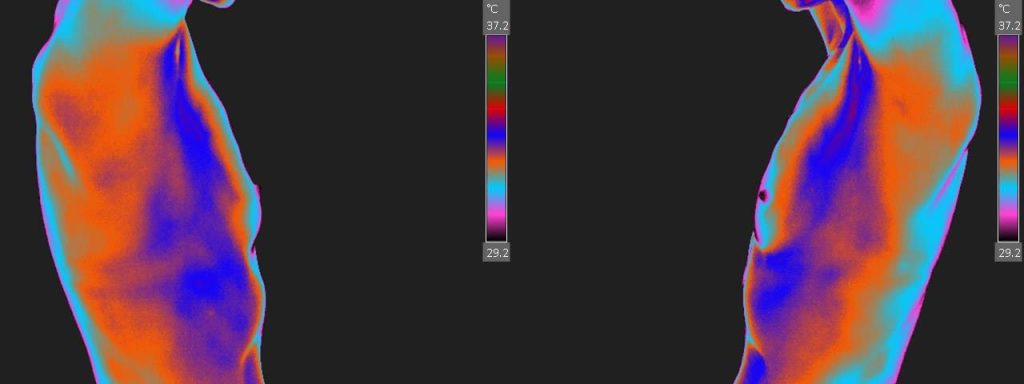 Nl-Breast-Lateral-View-Color-1920w