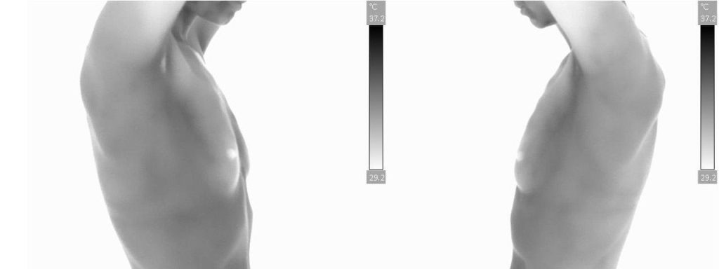 Nl-Breast-Latereal-View-Grey-Scale-1920w