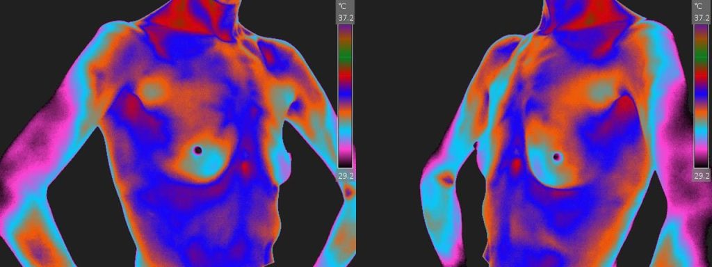 Nl-Breast-Oblique-View-Color-1920w