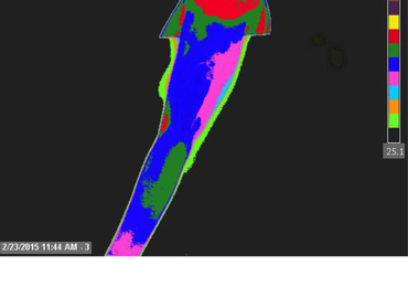 about-aat-thermography-01